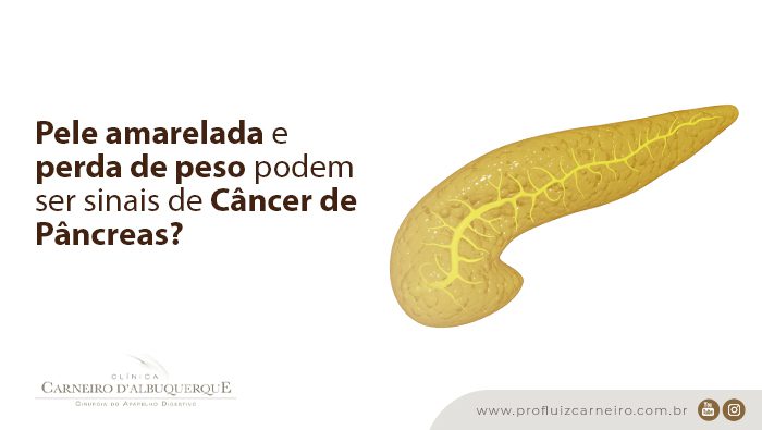 pele amarelada e perda de peso podem ser sinais de cancer de pancreas prof dr luiz carneiro bg