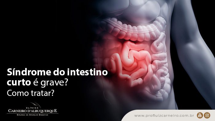 sindrome do intestino curto e grave como tratar prof dr luiz carneiro bg