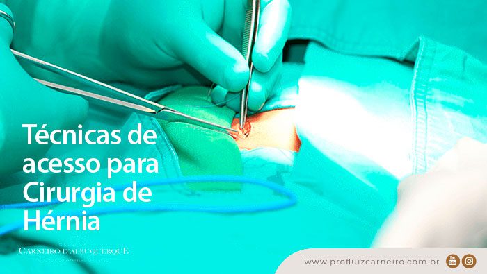 tecnicas de acesso para cirurgia de hernia prof dr luiz carneiro bg