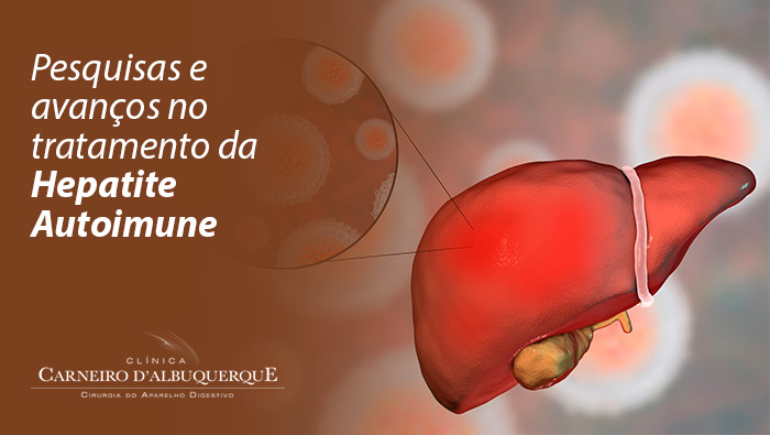 pesquisas e avancos no tratamento da hepatite autoimune BLOG Prof Dr. Luiz Carneiro