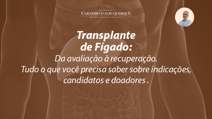 transplante de figado tudo o que voce precisa saber sobre indicacoes candidatos e doadores blog Prof Dr. Luiz Carneiro