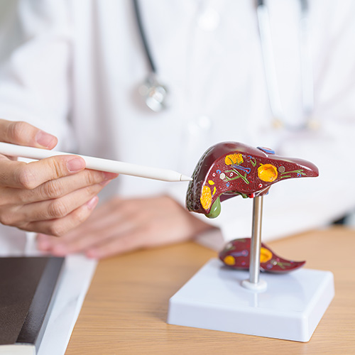 Médico apontando com uma caneta para um modelo anatômico de fígado sobre uma mesa, explicando a estrutura e possíveis condições hepáticas, com estetoscópio no pescoço.