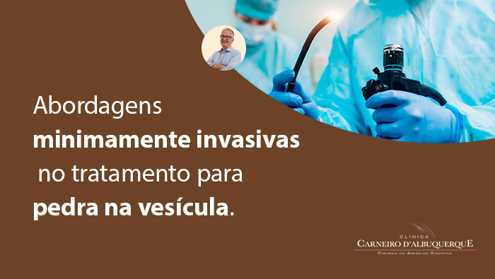 Médico segurando um endoscópio em uma sala de cirurgia, usando luvas e avental azul, indicando um procedimento minimamente invasivo, possivelmente relacionado a pedras na vesícula.