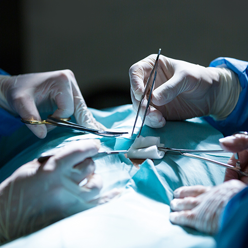 Esplenectomia: Entenda Como Funciona A Cirurgia De Retirada Do Baço ...