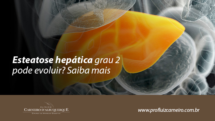 Esteatose Hepática Grau 2 Pode Evoluir? Saiba Mais - Prof Dr. Luiz Carneiro