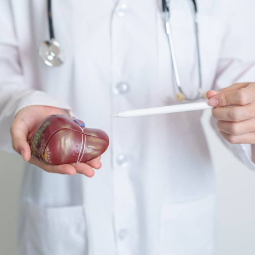 Médico segurando modelo de fígado em mãos, com caneta apontando para a estrutura, representando explicação sobre doenças hepáticas.
