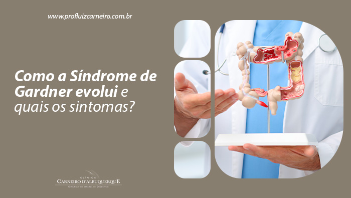 Médico segurando modelo anatômico do intestino grosso, destacando áreas internas para explicar doenças ou condições do órgão.