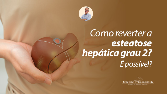 Pessoa segurando modelo anatômico do fígado sobre o abdômen, representando cuidado e atenção à saúde hepática.