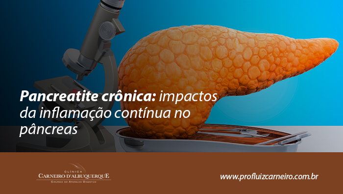 Modelo anatômico de pâncreas ao lado de um microscópio, representando análise científica e investigação de alterações inflamatórias no órgão.