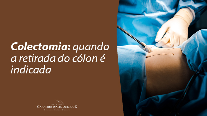 Procedimento cirúrgico abdominal com equipe médica manipulando instrumentos em campo estéril durante operação.