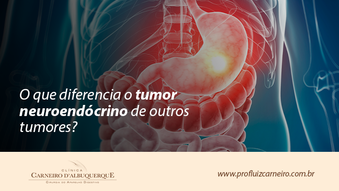 Ilustração anatômica do sistema digestivo destacando estômago e intestinos, com área inflamada em evidência na região gástrica.