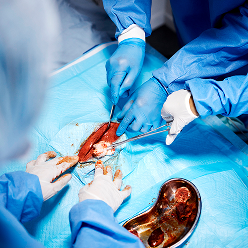 Equipe médica realiza procedimento cirúrgico com instrumentos, em campo estéril e ambiente hospitalar.