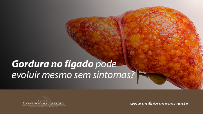 Ilustração de fígado com aspecto irregular e acúmulo de gordura, representando doença hepática gordurosa.