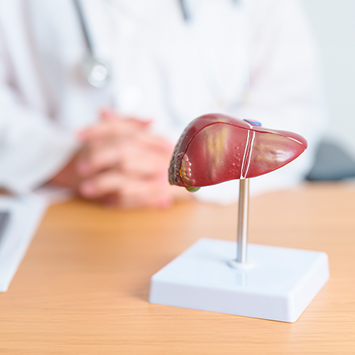 Modelo anatômico de fígado em destaque sobre mesa, com médico desfocado ao fundo em ambiente clínico.