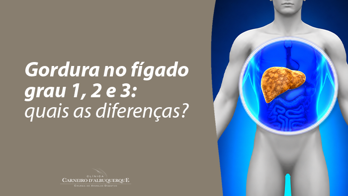 Ilustração do corpo humano com destaque para o fígado, representando os diferentes graus de gordura no fígado (esteatose hepática).
