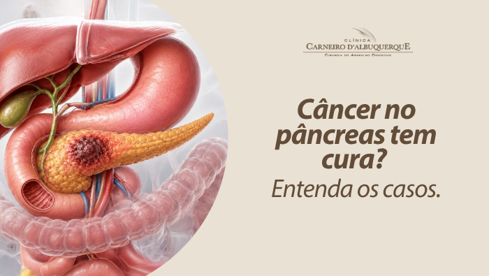 Arte sobre câncer no pâncreas e possibilidades de tratamento