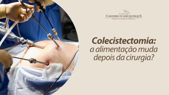 Arte sobre colecistectomia e dieta no pós-operatório