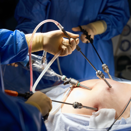 Cirurgia de colecistectomia por videolaparoscopia