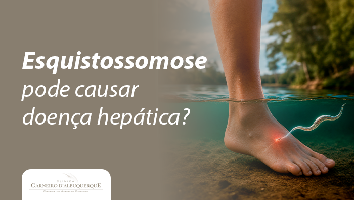 Arte sobre esquistossomose e risco de doença hepática