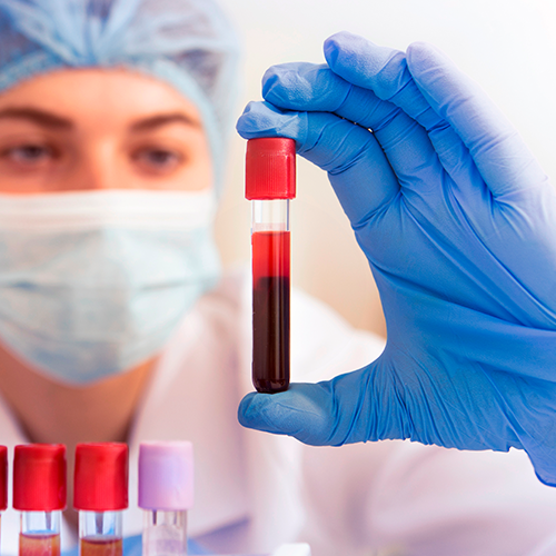 Profissional analisando tubo de sangue em exame laboratorial