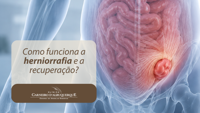 Arte sobre herniorrafia e recuperação após cirurgia de hérnia