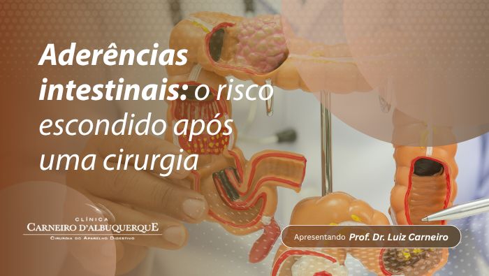 Arte sobre aderências intestinais após cirurgia