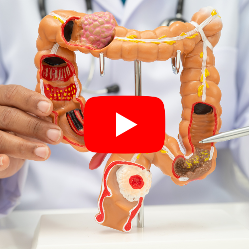 Médico apontando para modelo anatômico do intestino