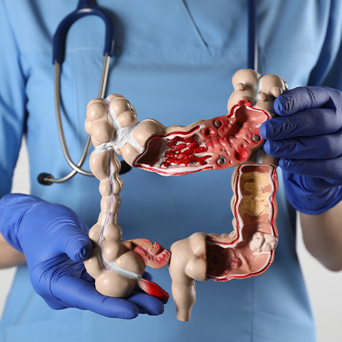 Profissional de saúde segurando modelo anatômico do intestino grosso