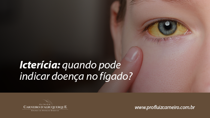 Arte sobre icterícia e sua relação com doenças do fígado