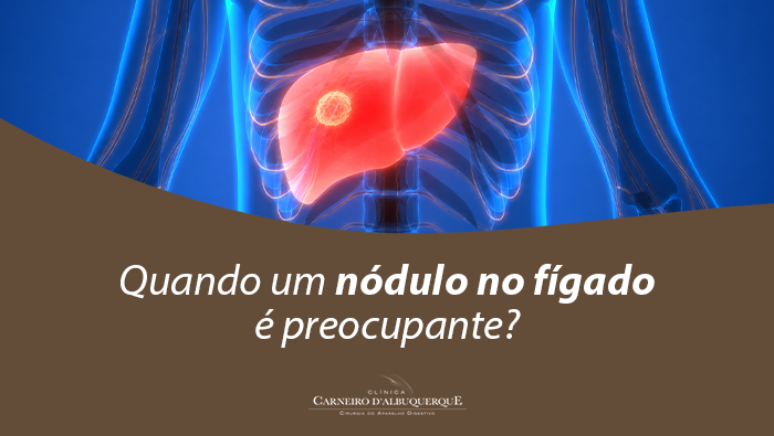 Arte sobre avaliação de nódulos no fígado e possíveis riscos